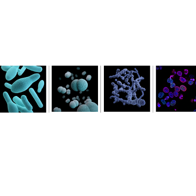 Undergraduate Pathophysiology for Nurses
