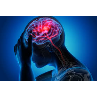 Systematic Review on Kinematic Assessments of Upper Limb Movements After Stroke