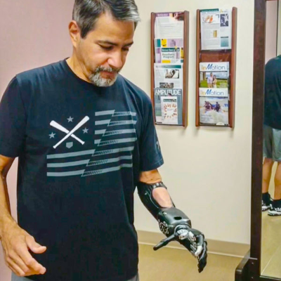 How Do Prosthetic Arms Work? icon