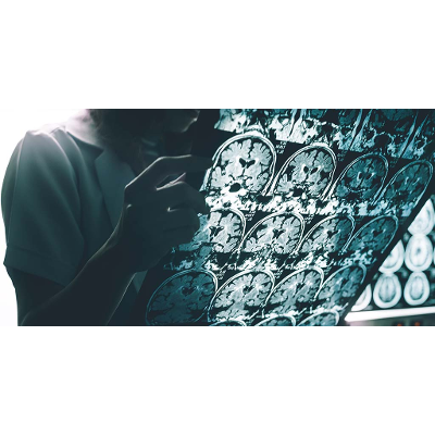 Neurodegenerative Diseases