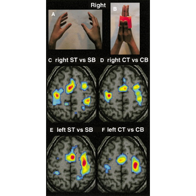 I Feel My Hand Moving - A New Role of the Primary Motor Cortex in Somatic Perception of Limb Movement