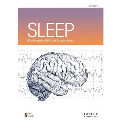 Periodic Limb Movements During Sleep Mimicking REM Sleep Behavior Disorder: A New Form of Periodic Limb Movement Disorder icon