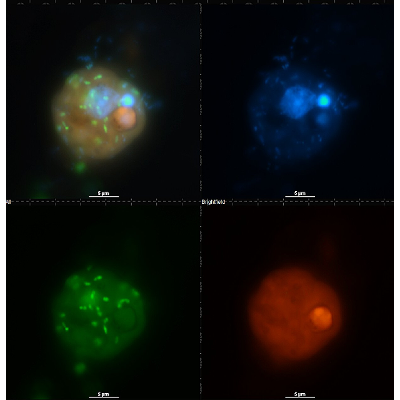 Climate change may cause lake phytoplankton to become predatory, putting more CO₂ into the atmosphere icon