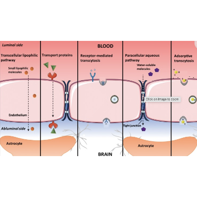 Delivery across the blood-brain barrier: nanomedicine for glioblastoma multiforme icon