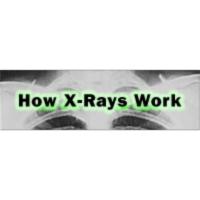 How X-Rays Work icon