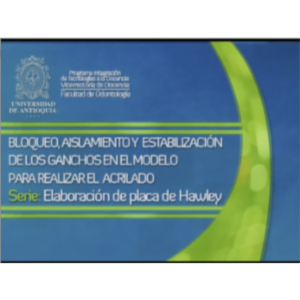 Bloqueo, aislamiento y estabilización de los ganchos en el modelo para realizar el acrilado icon