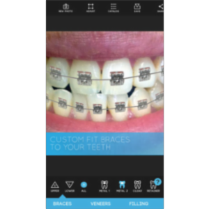 Virtual Dentist App for iOS