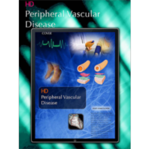 HD Peripheral Vascular Disease App for iPad icon