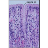 Pathophysiology of the Digestive System icon