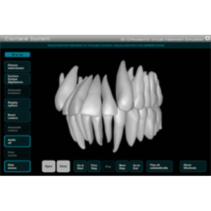 Carriere Ortho 3D App for iOS